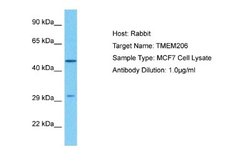 TMEM206 Rabbit anti-Human, Polyclonal, Novus Biologicals 0.1 mL | Buy Online | Novus Biologicals | Fisher Scientific